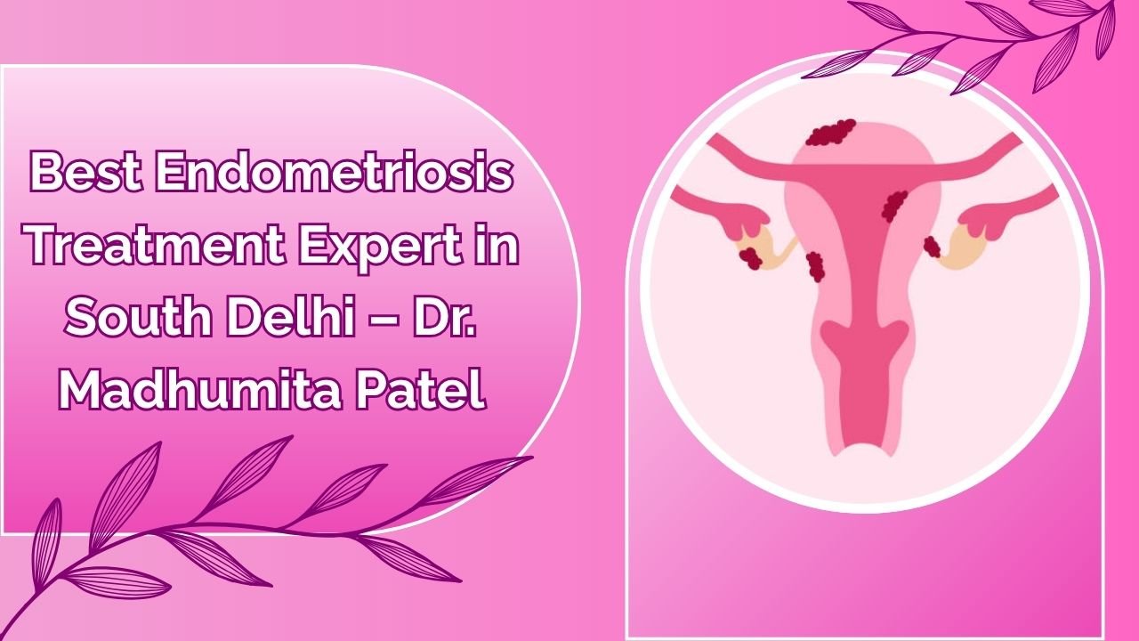 Understanding Endometriosis – Why Timely Diagnosis Is Crucial