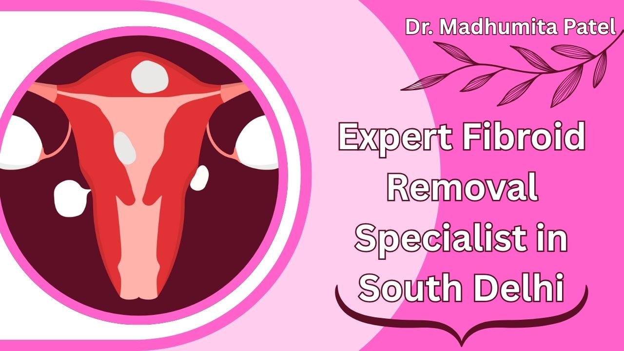 Uterine Fibroids – Symptoms, Risks, and Modern Treatment Options