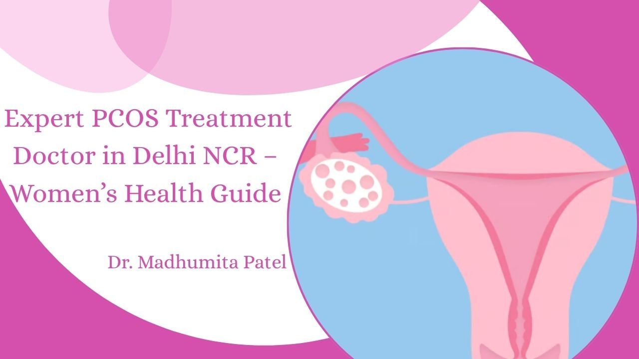 expert pcos treatment doctor in delhi ncr