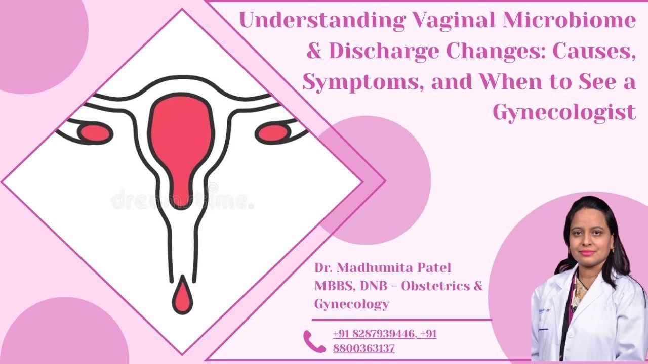 abnormal vaginal discharge treatment in Delhi NCR