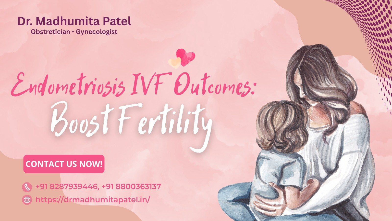 Endometriosis IVF outcomes