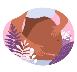 C-Section recovery tips